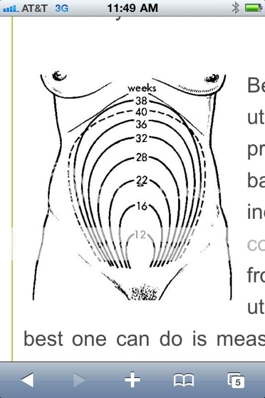 Where is your uterus? Drawing attached - BabyCenter